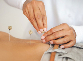 طب سوزنی و دیابت