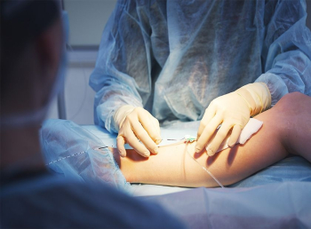 مراقبت از زخم جراحی و نکات مهم مربوط به آن