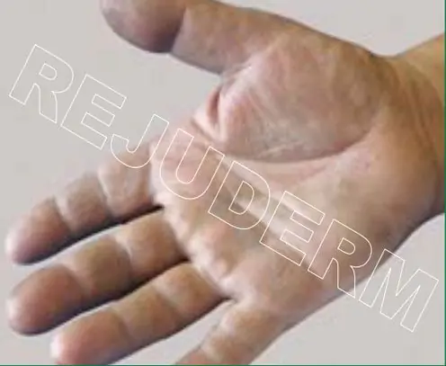 زبری و ضخامت پوست